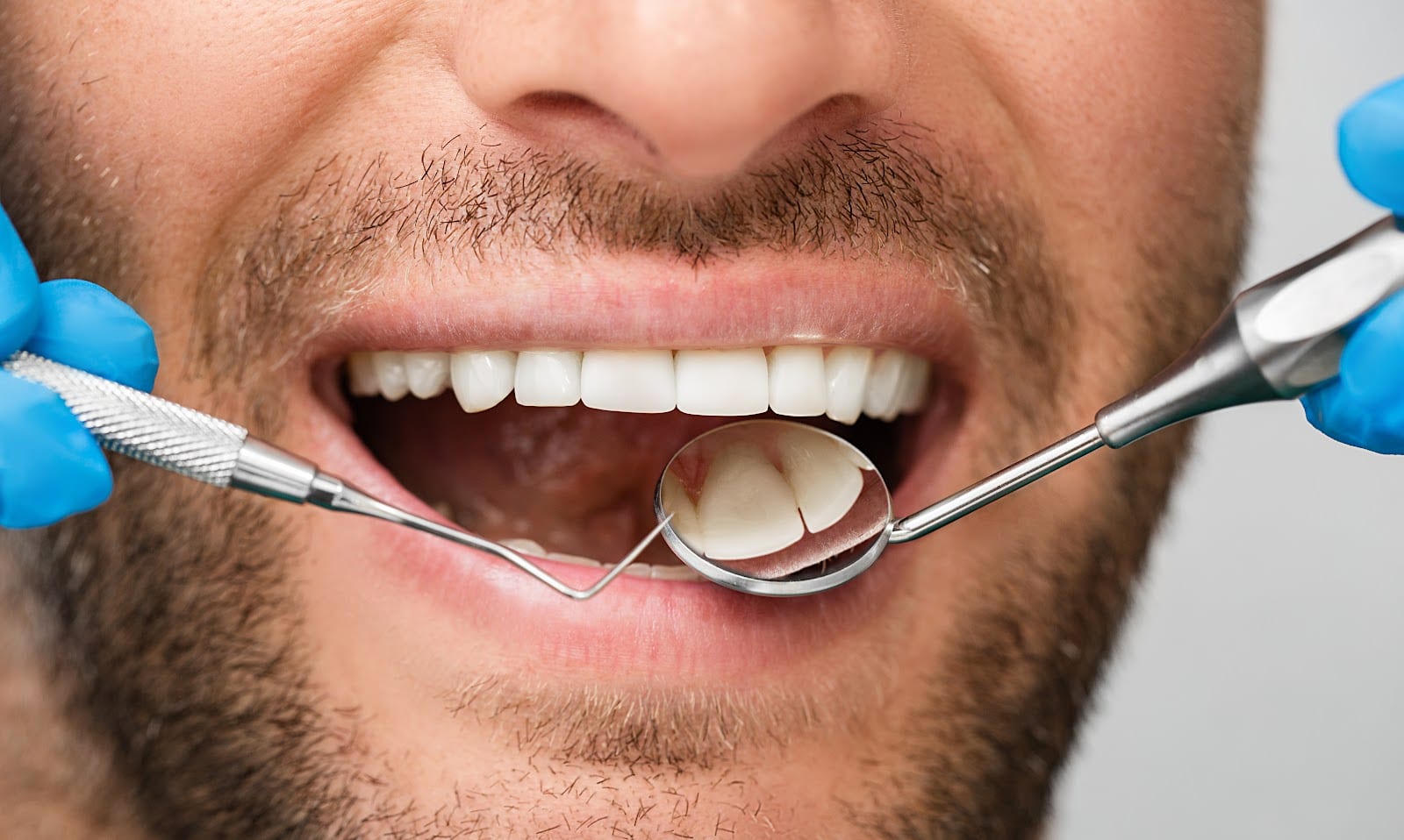 Logan Smiles: Scott L. Theurer, DMD; Brad C Theurer, DDS, photo 2