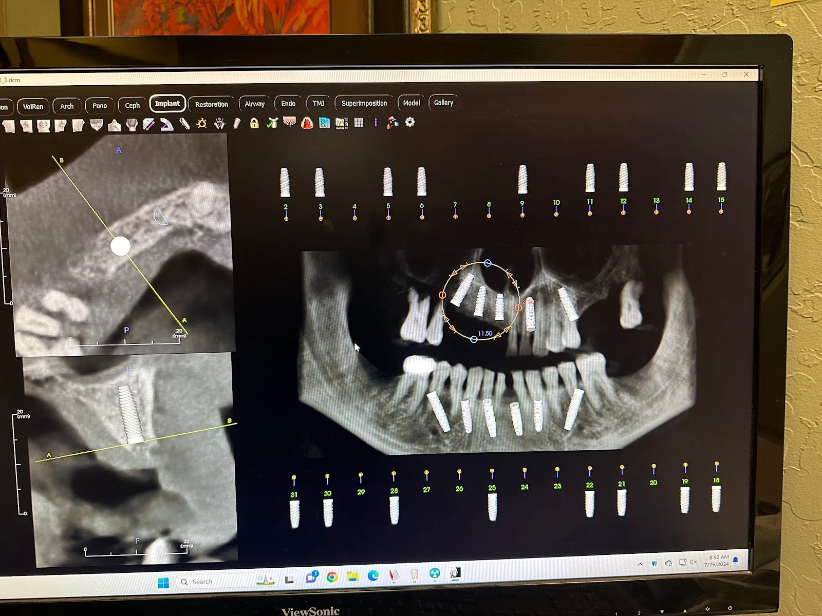 My Scottsdale Dentist Orthodontics & Implants