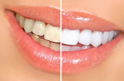 White Smile Center