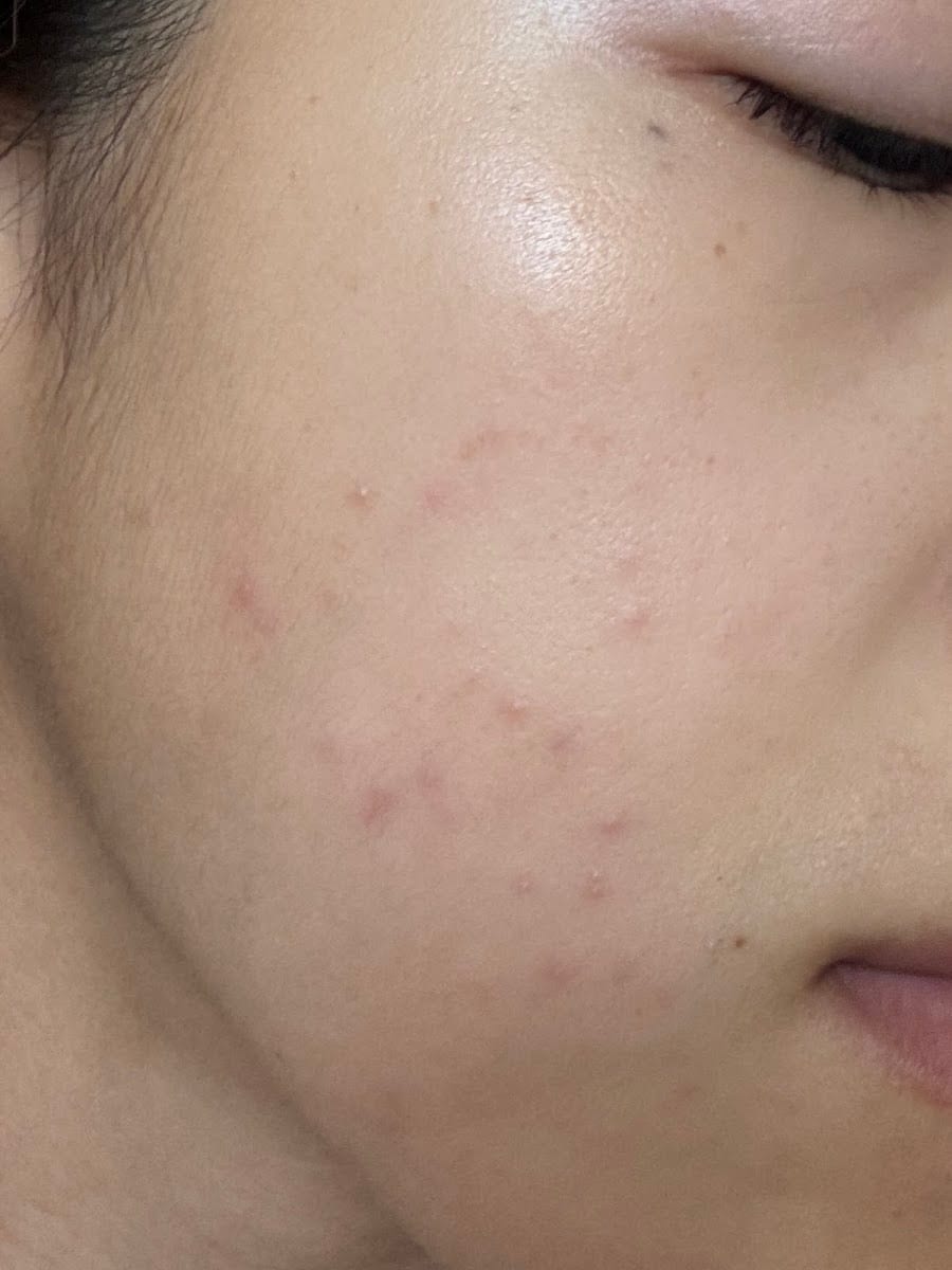 California Skin Institute, photo 2