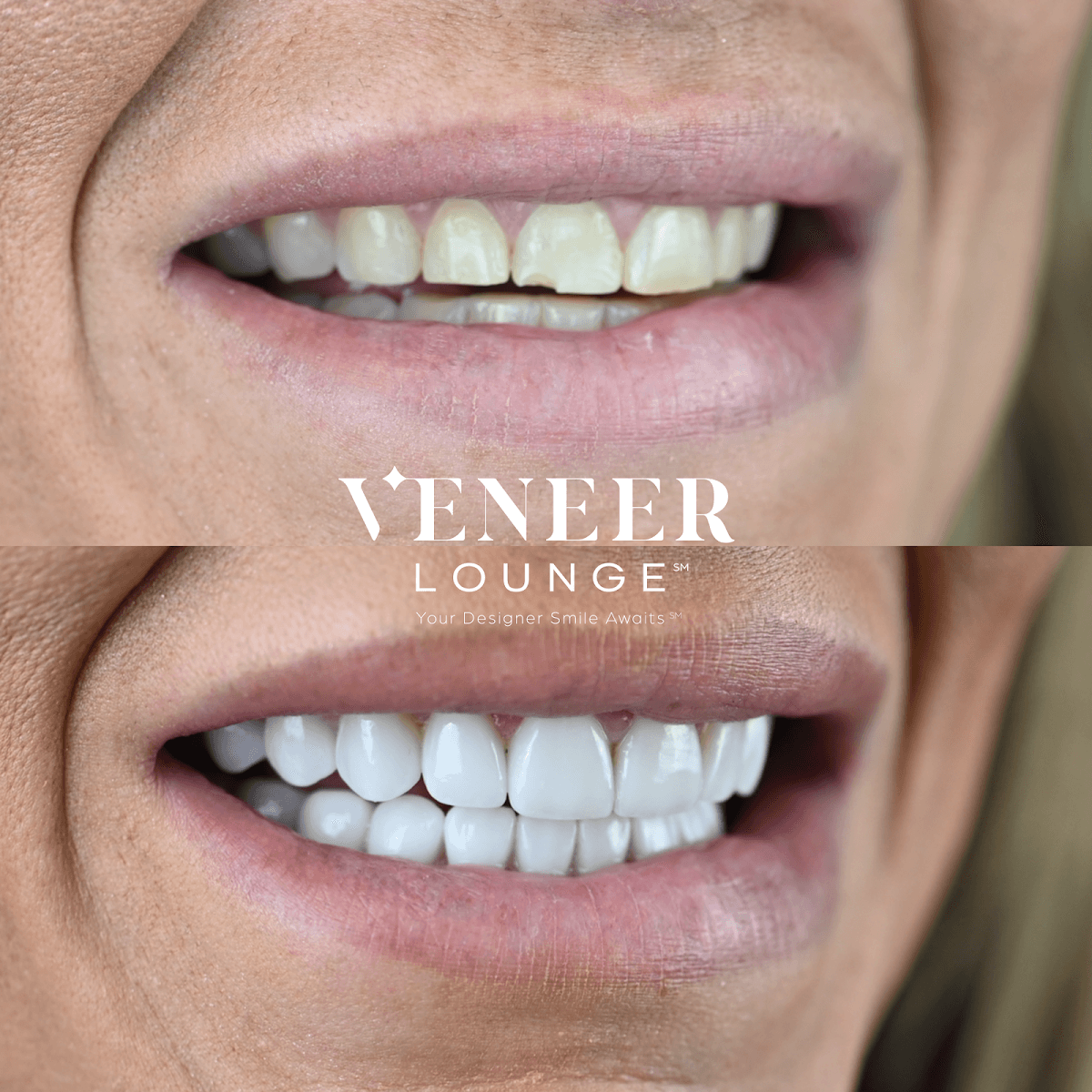 Modern Bite Dentistry