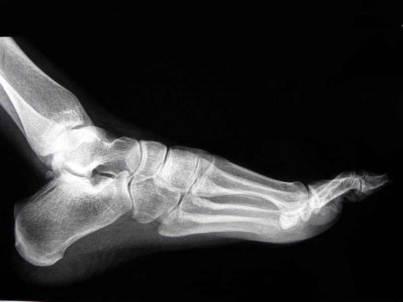 Quality Foot Care - An Affiliate of Curalta Foot + Ankle, photo 2