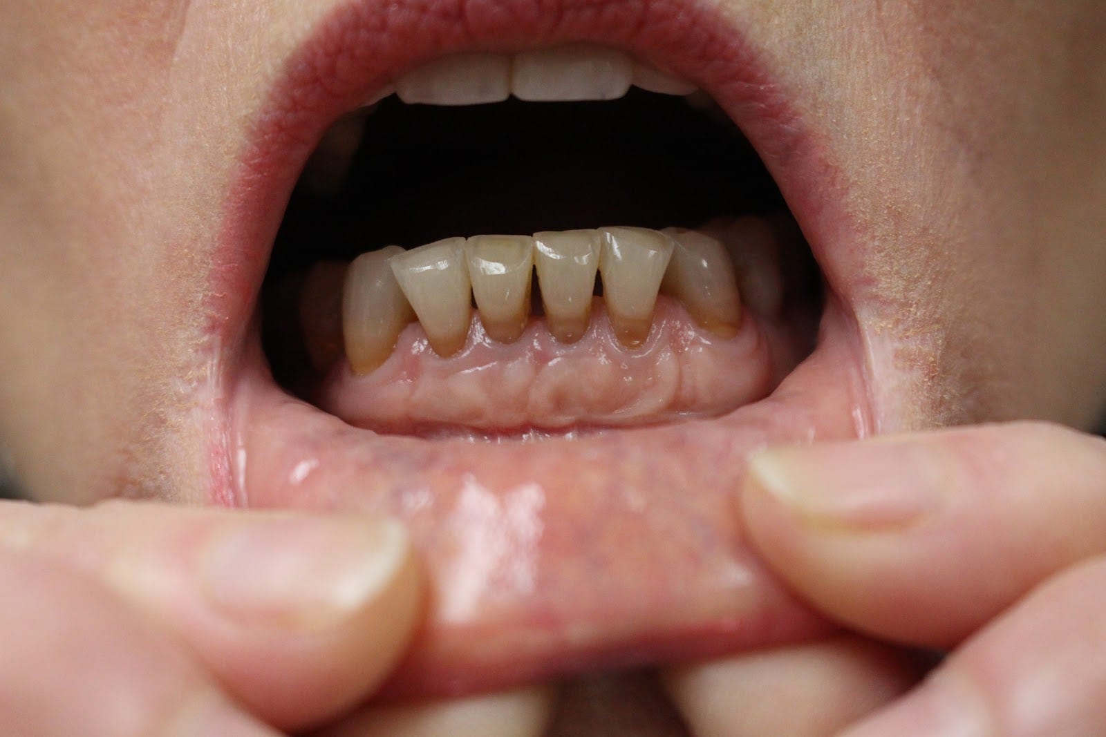 Leah Olson, DMD, Cosmetic and Family Dentistry, photo 4