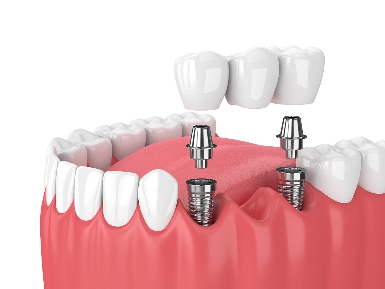 Anderson General Dentistry, photo 4