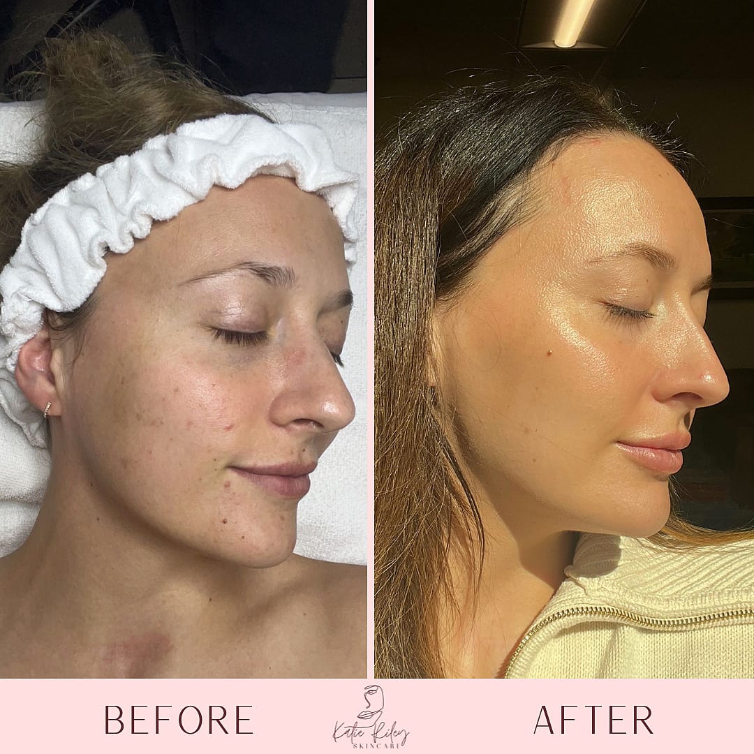 Katie Riley Skincare