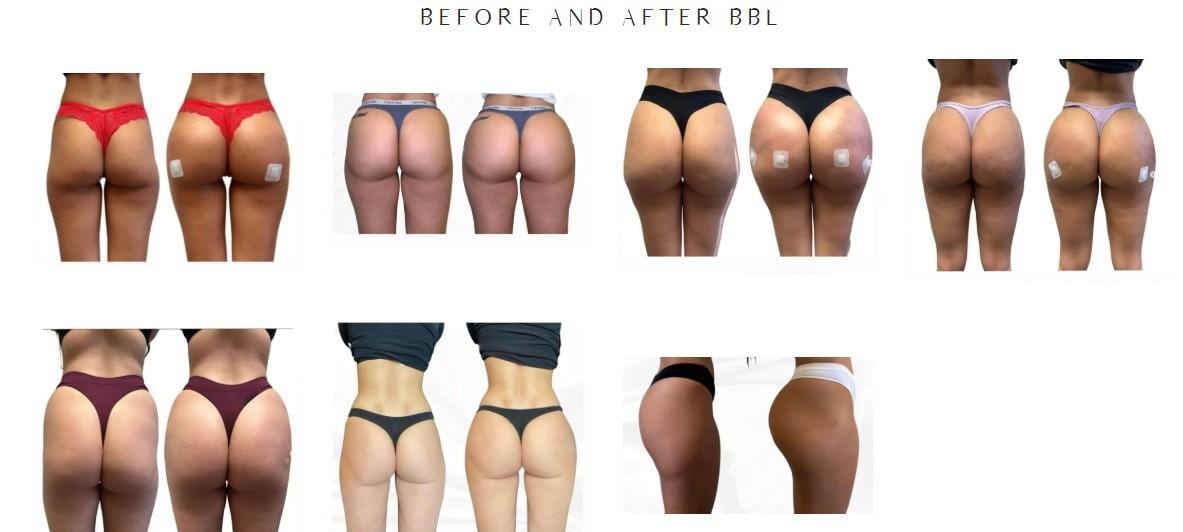 Celebrity Body Sculpting & Aesthetics, photo 4