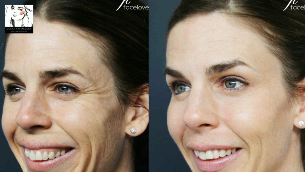 DERMA ART MedSpa