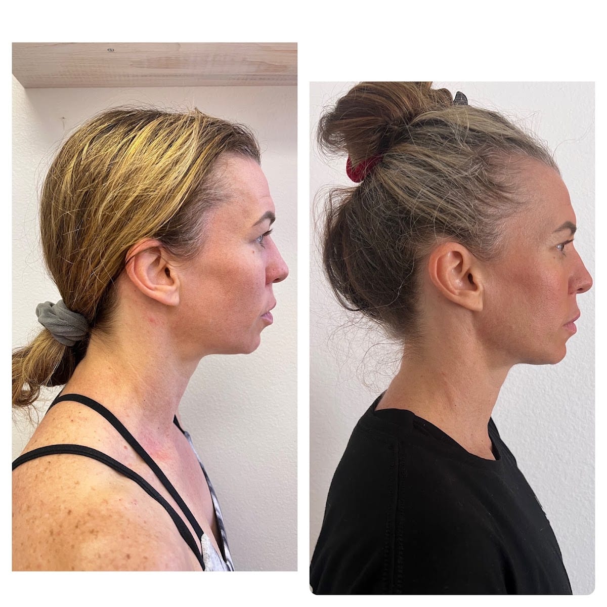 Eternal Youth massage by Anastasia