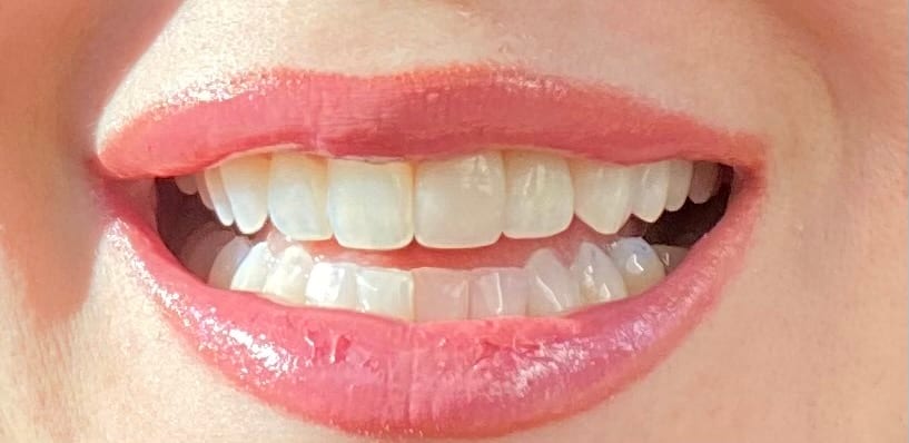 York Mills Family Dentistry, photo 4