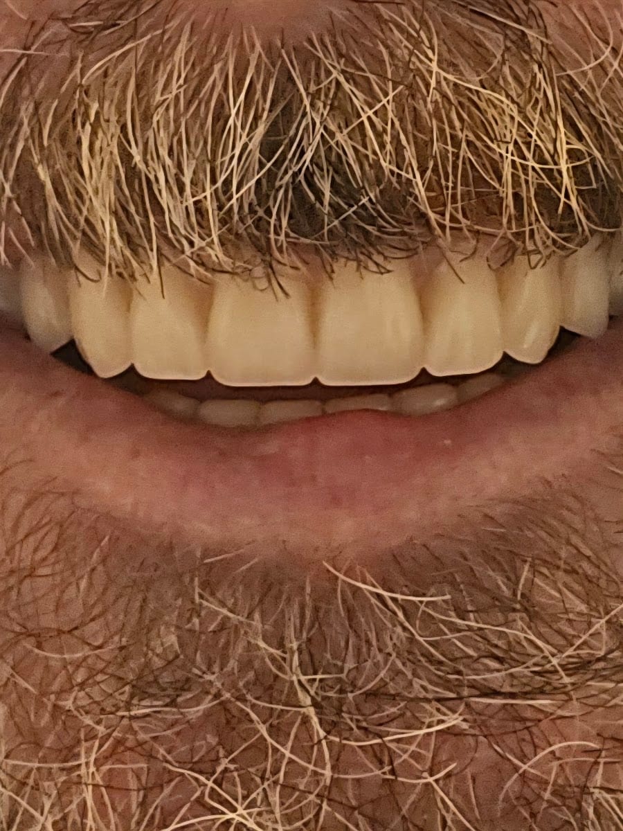 Lilly Denture Center: Patrick Carbone, DPD, photo 2