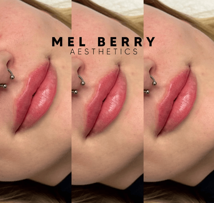 Mel Berry Aesthetics, photo 3