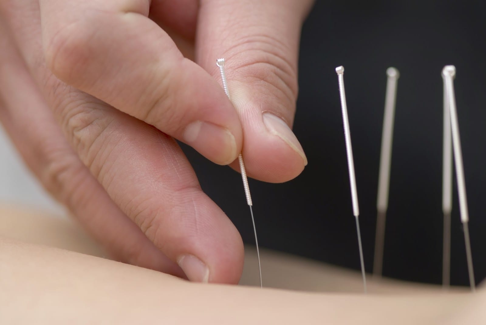 Richmond Hill Acupuncture and Natural Therapy Clinic, photo 2