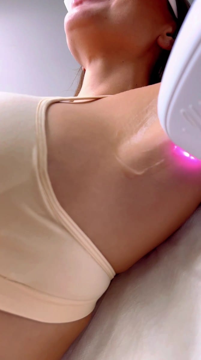 Laser Hair Removal | Endosphere Therapy | Eyelash extension | Wow Wow, photo 3