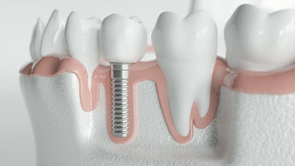 Mills Haven Dental, photo 4
