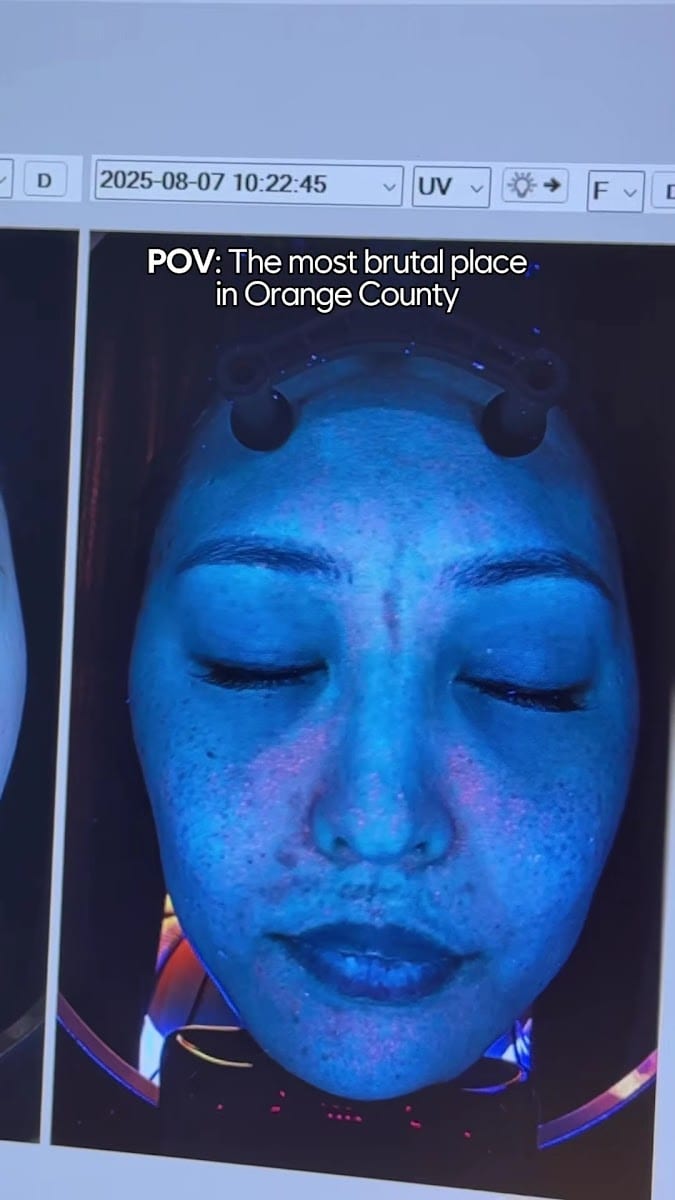MeSO Medspa Newport Beach, photo 3