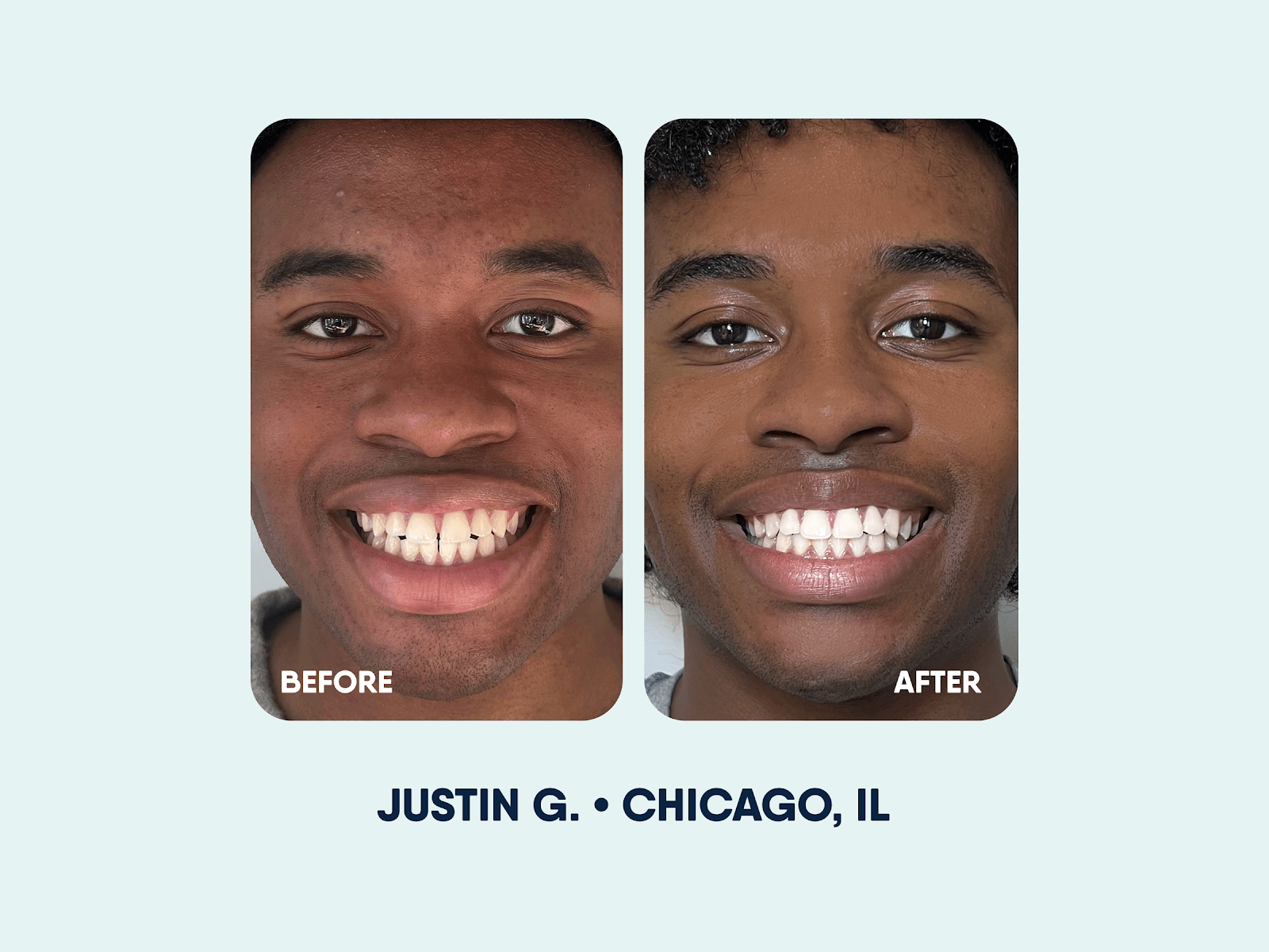 Motto Clear Aligners, photo 3