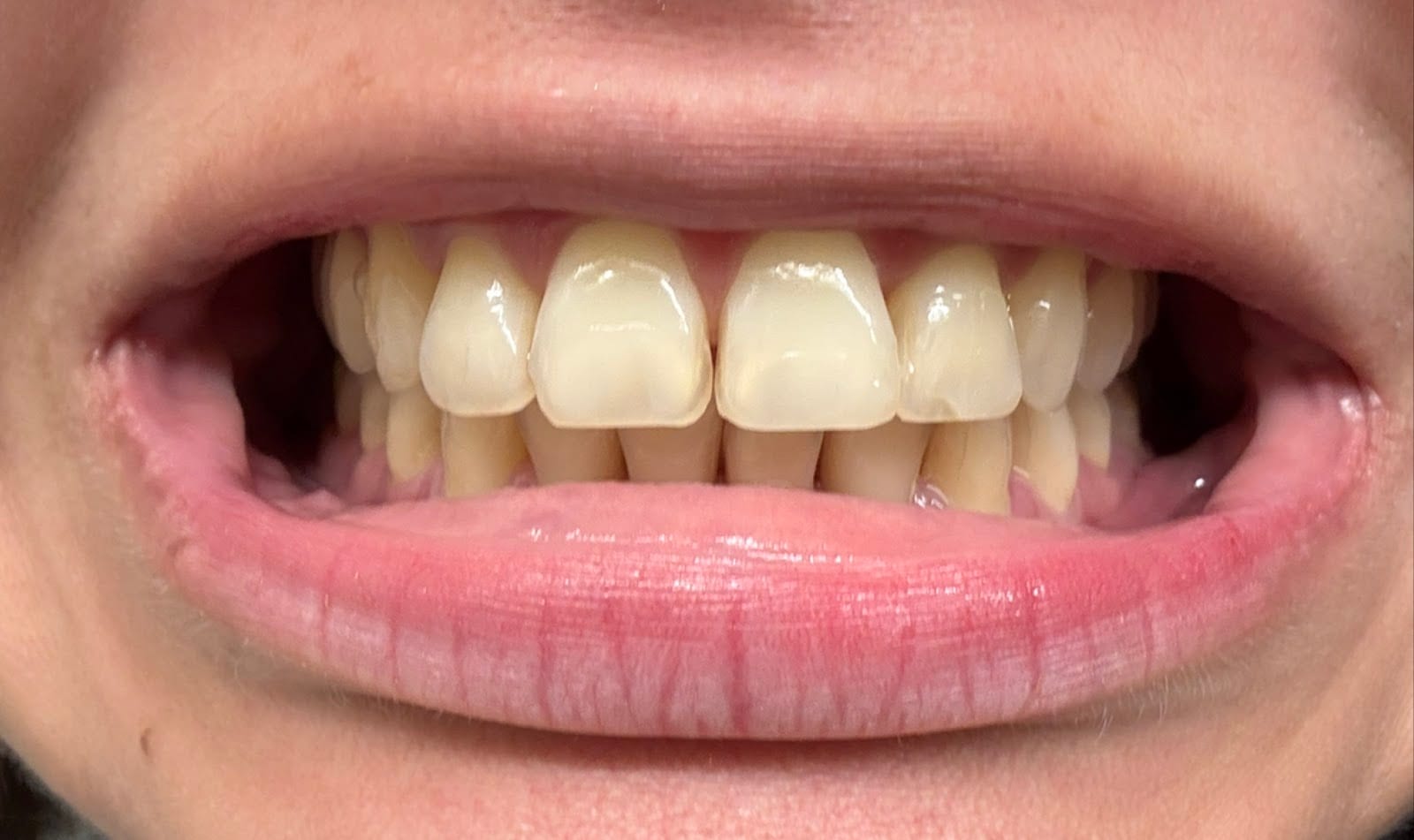 Gentle Dentistry, photo 3