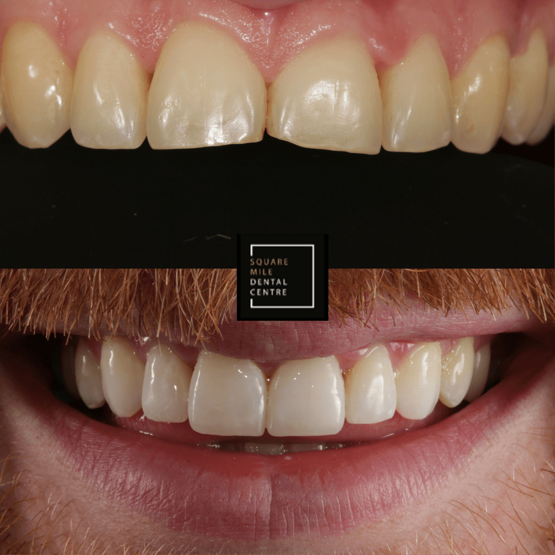 Square Mile Dental Centre