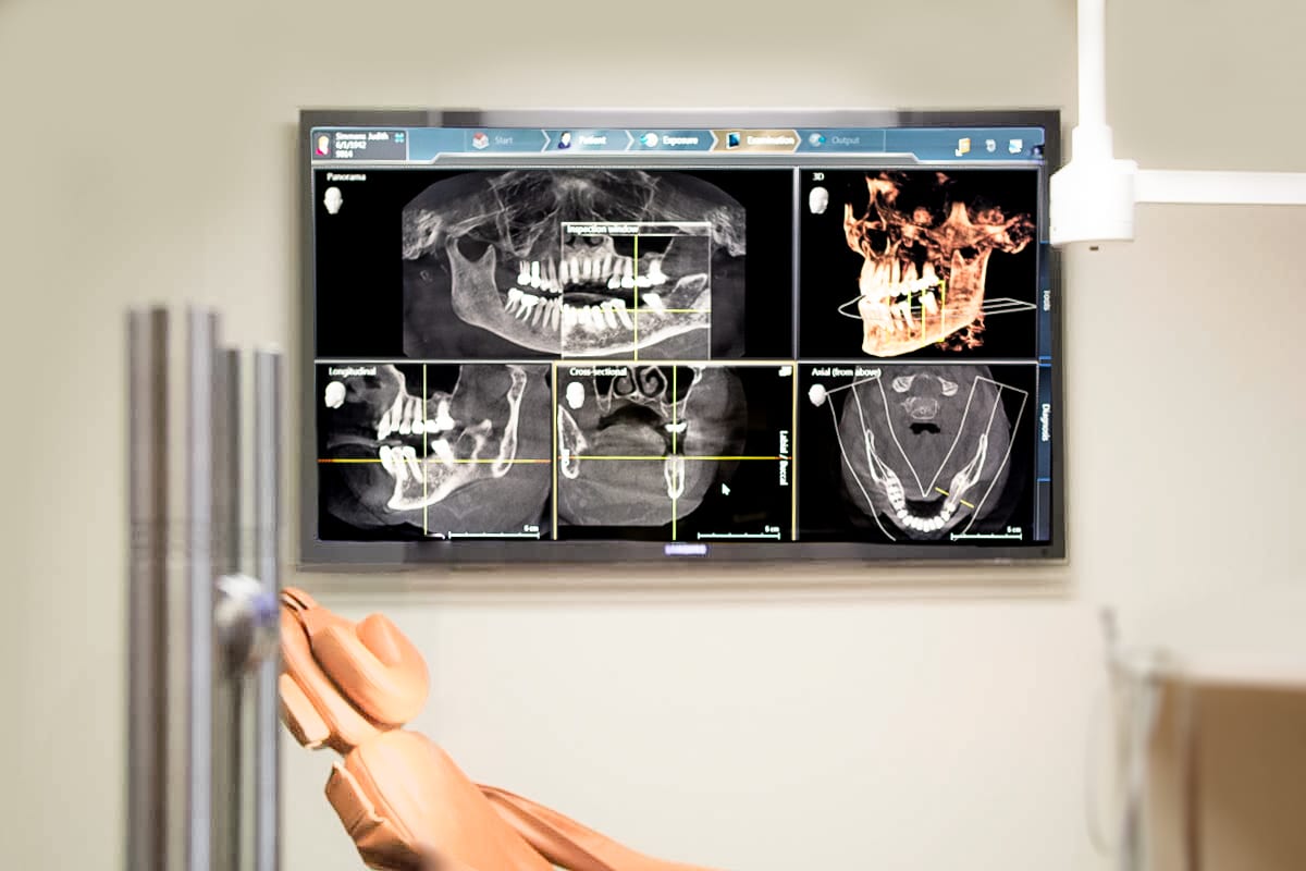 Scott Middleton Oral Surgery - Sarasota Oral and Implant Surgery, photo 4