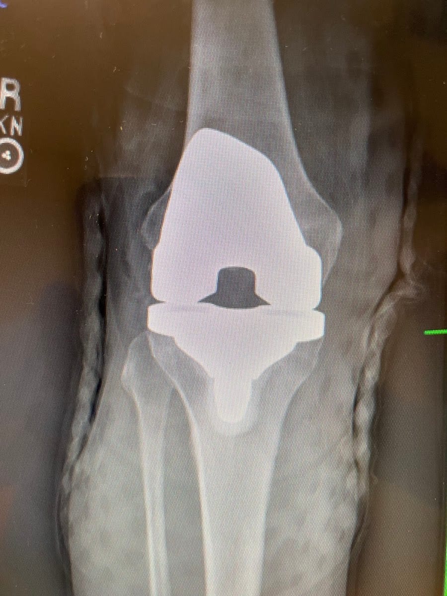 John N Diana, MD, photo 2
