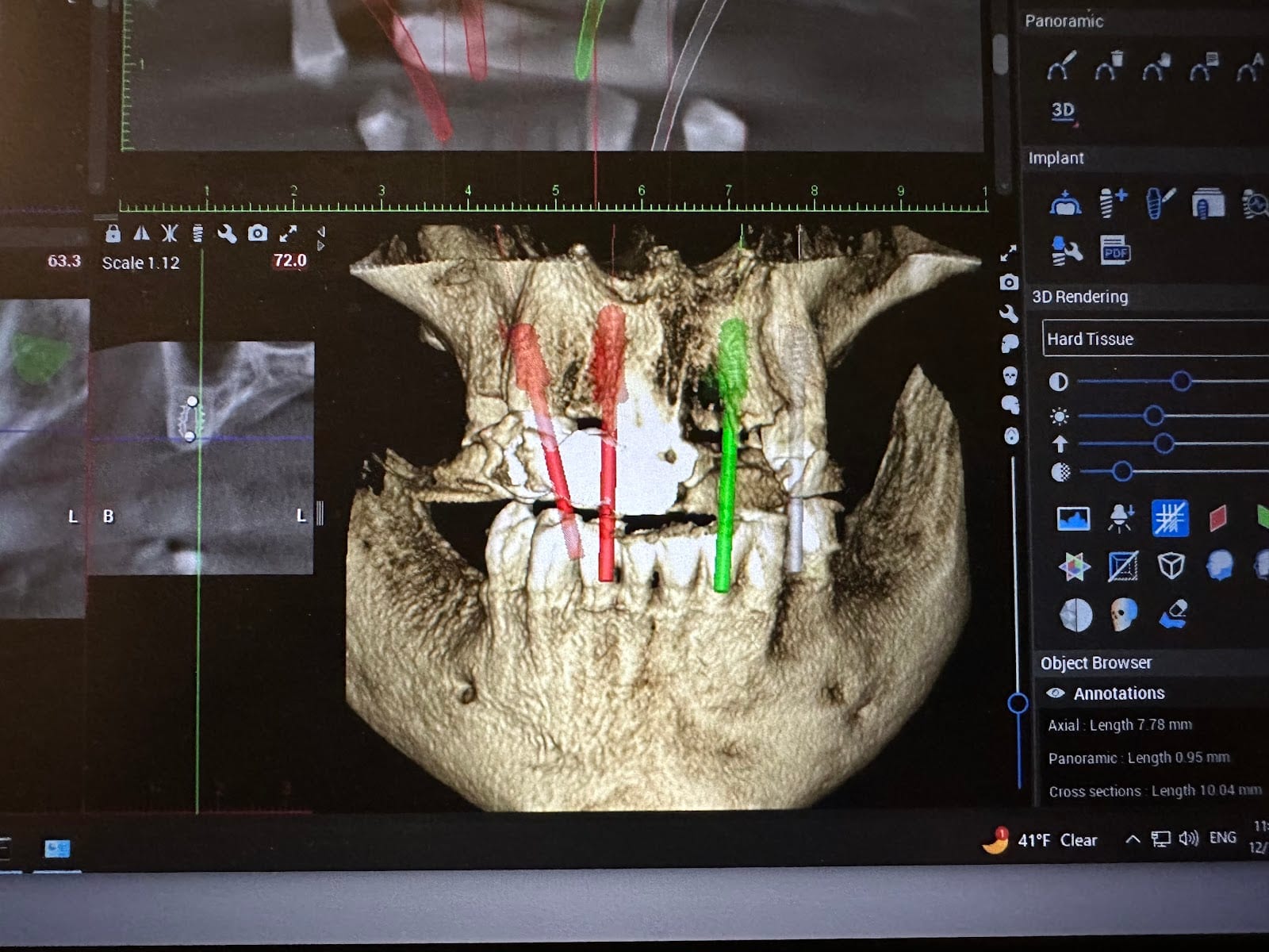 The Aubrey Dentist, photo 4