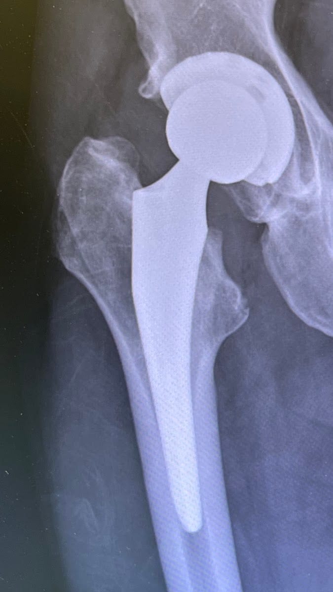 Perry J. Evangelista, MD