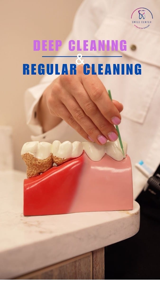 Doylestown Smile Center same day emergency, implants, and laser dentistry, photo 4