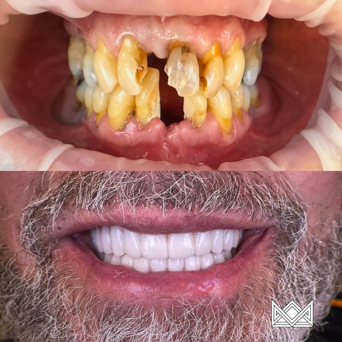Crown Dental, photo 4