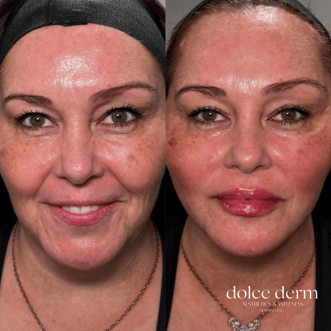 Dolce Derm Aesthetics & Wellness Nursing Inc., photo 2