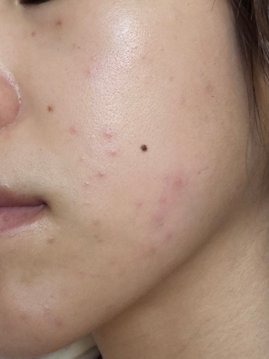 California Skin Institute
