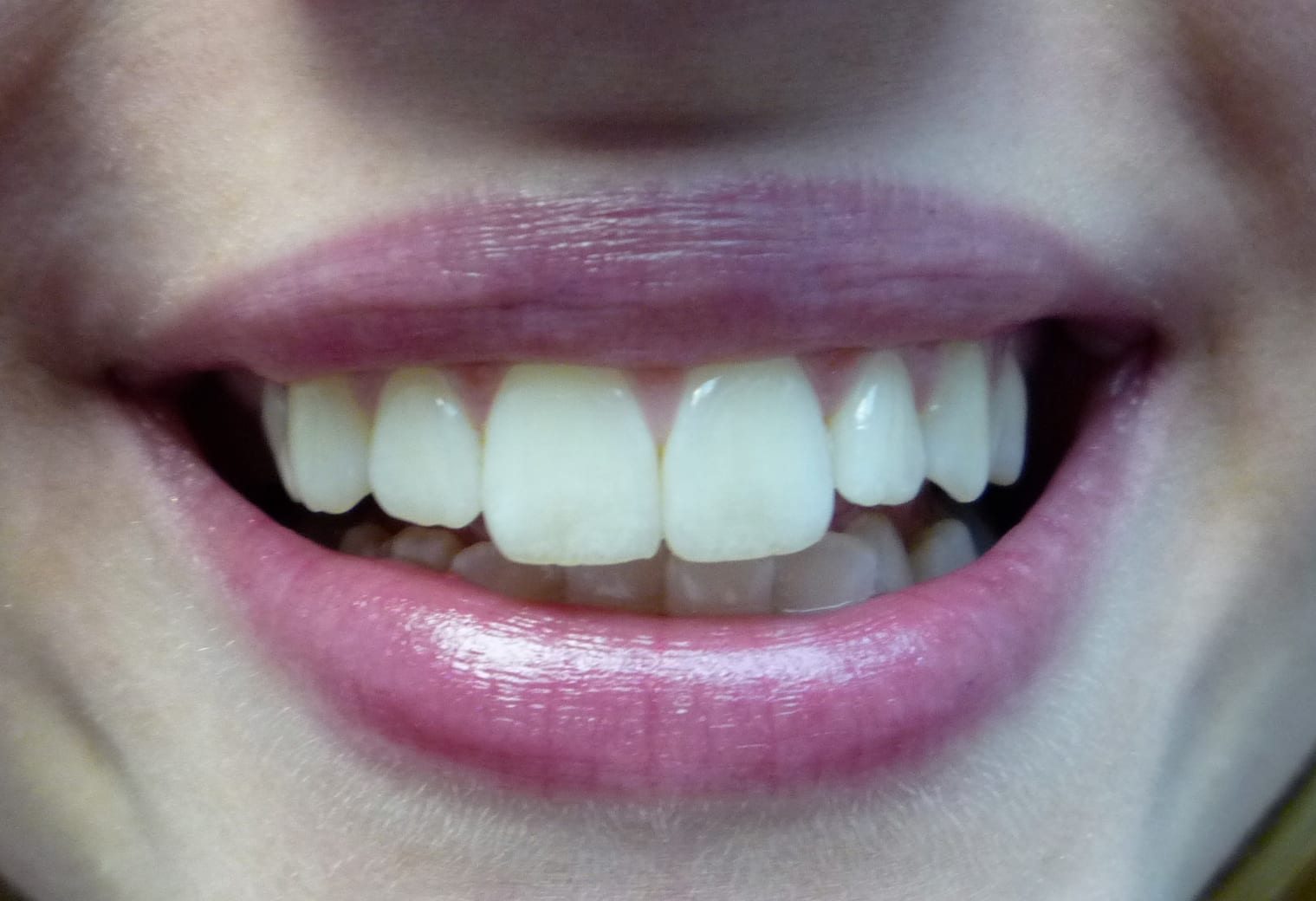 1st Choice Dental Sarasota