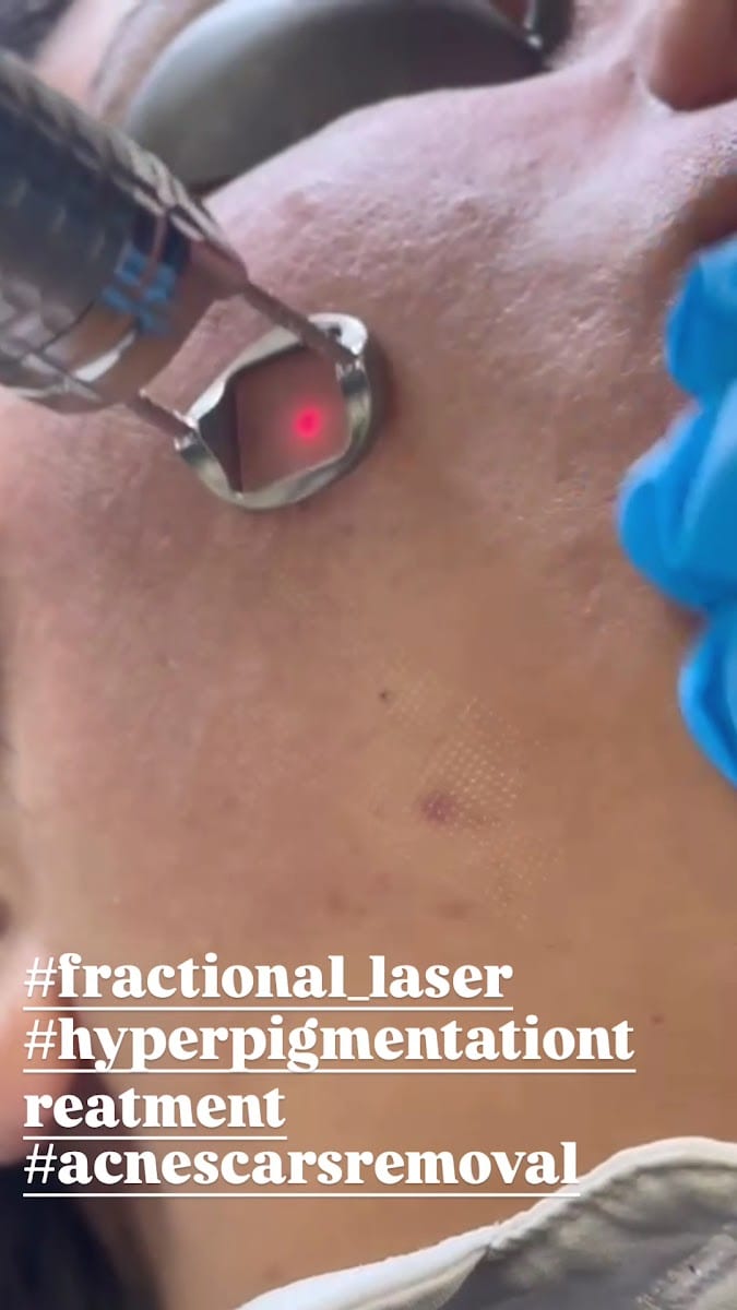 Dermalex Facial By Setare, photo 3