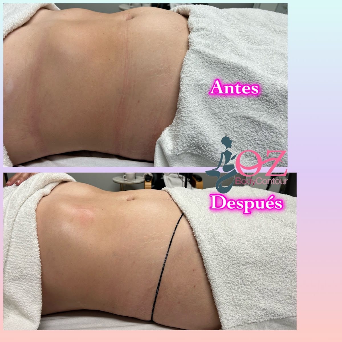 Oz body contour, photo 2