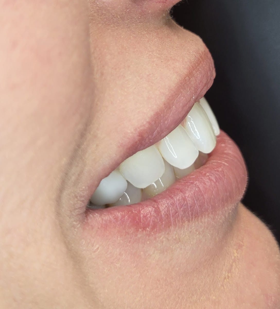 Dalton Dental, photo 4