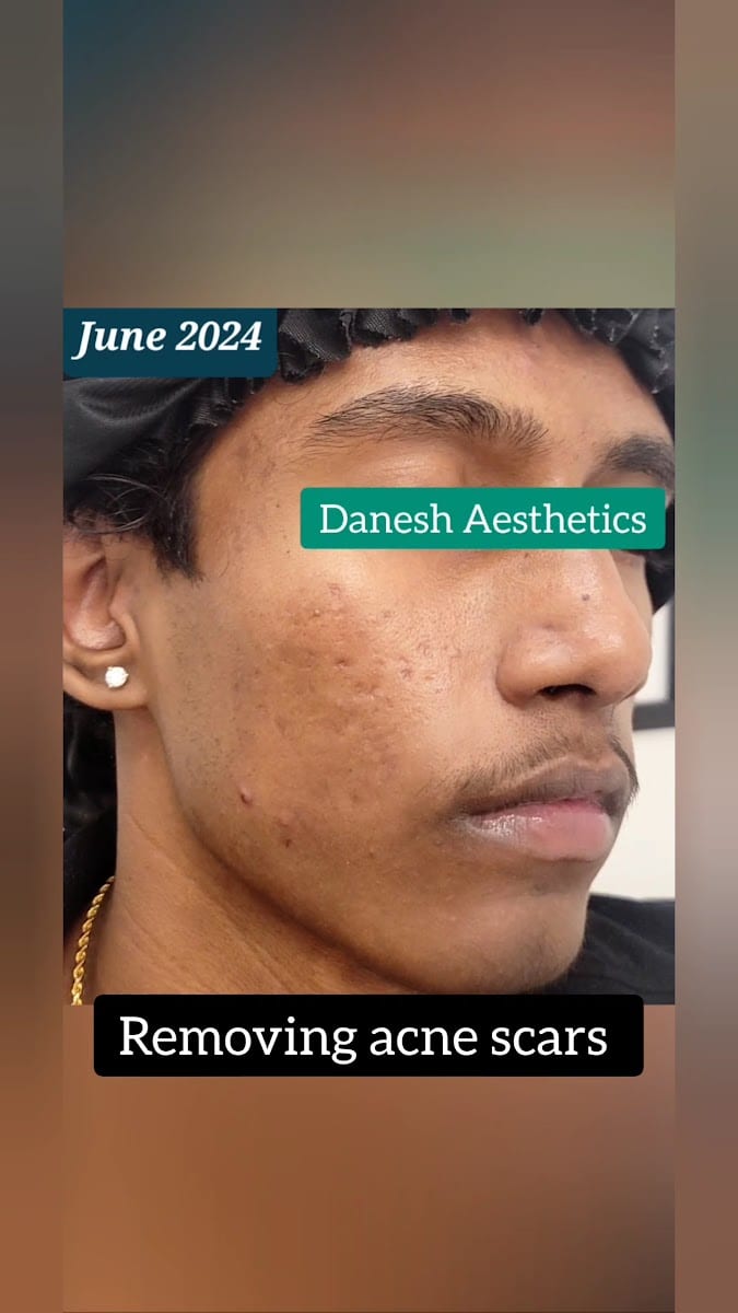 Danesh Aesthetics Dr.M.Danesh ND (Dermatology-Focused)
