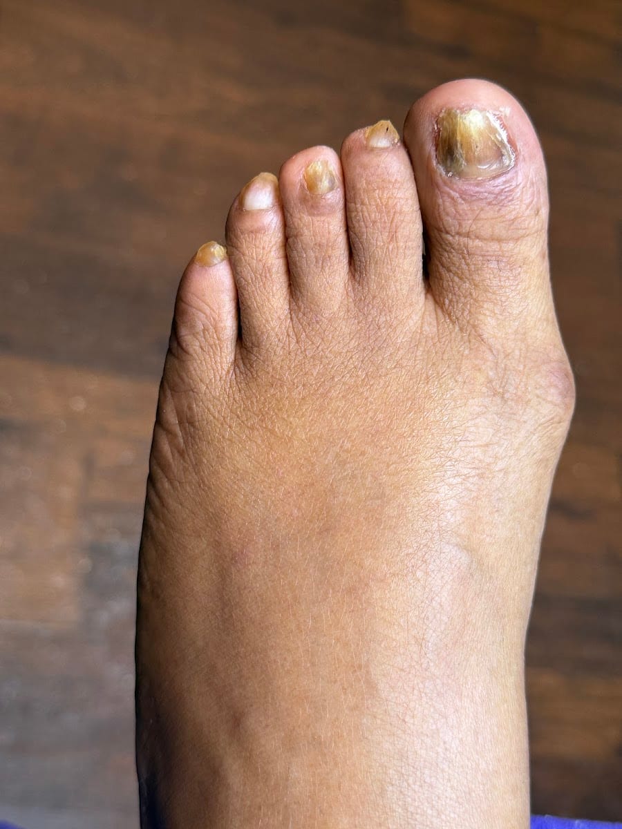 Naturally Nailed Restorative Foot & Nail Care, photo 2