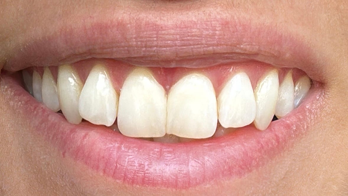 Springhill Dental