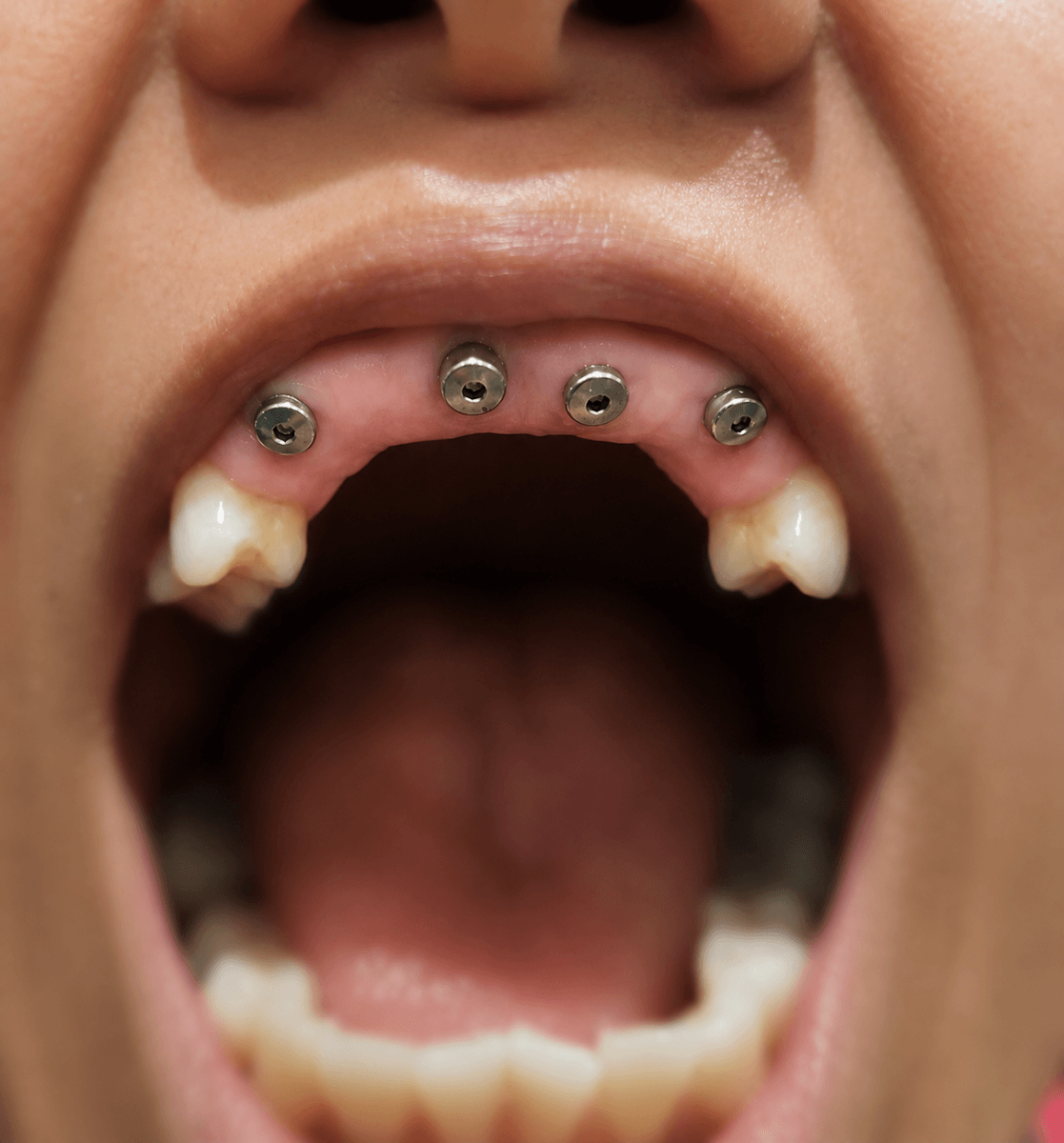 Clove Dental