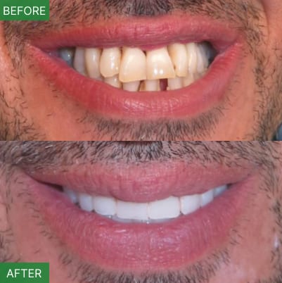 NJ Implant Dentist | All-on-4 & Full Arch Expert, photo 2