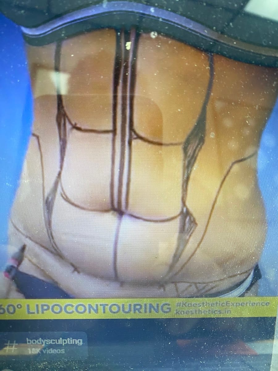 Celebrity Body Sculpting & Aesthetics, photo 3