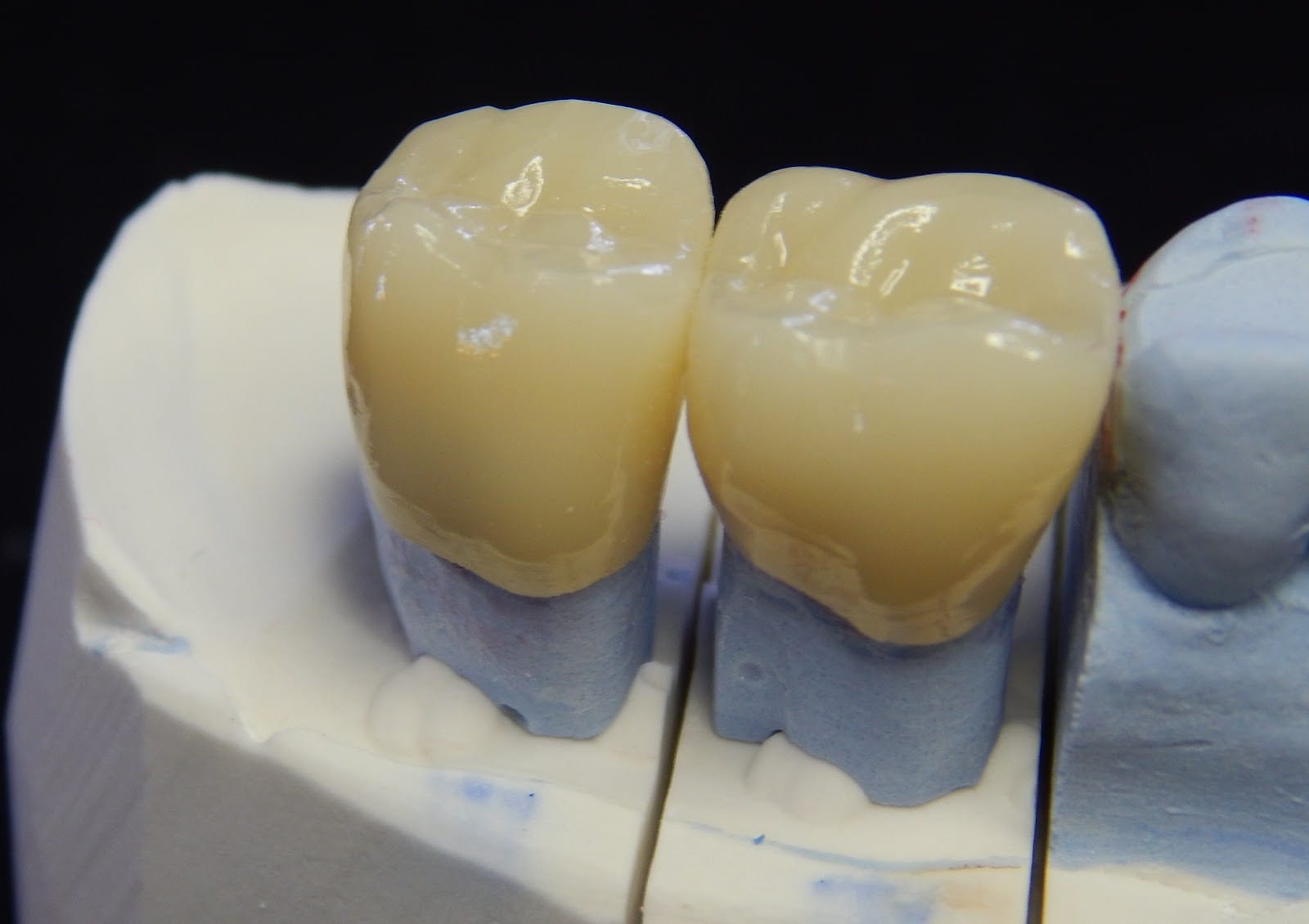 Pioneer Dental Studio Inc., photo 2