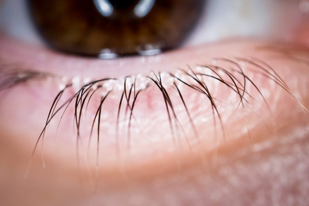 Mad Lashes, photo 2