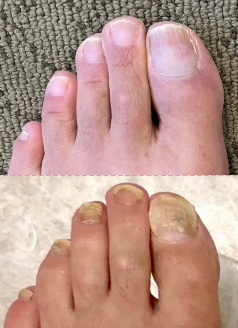 Bay Area Fungal Nail Clinic, photo 3