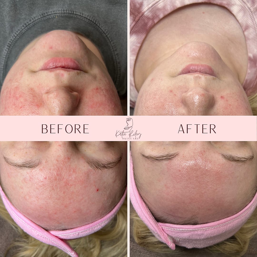 Katie Riley Skincare, photo 2