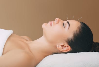 Creative Acupuncture