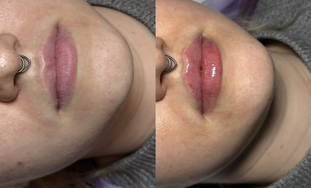 Mel Berry Aesthetics, photo 4