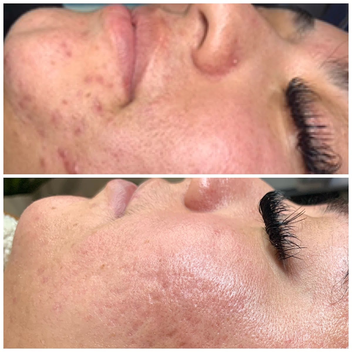Skin Solutions Acne Clinic