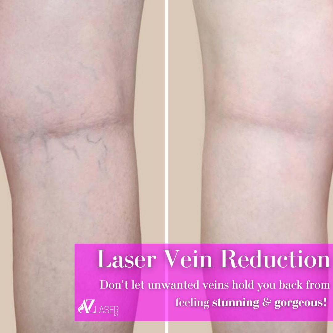 AZ Laser RX Med Spa, photo 3