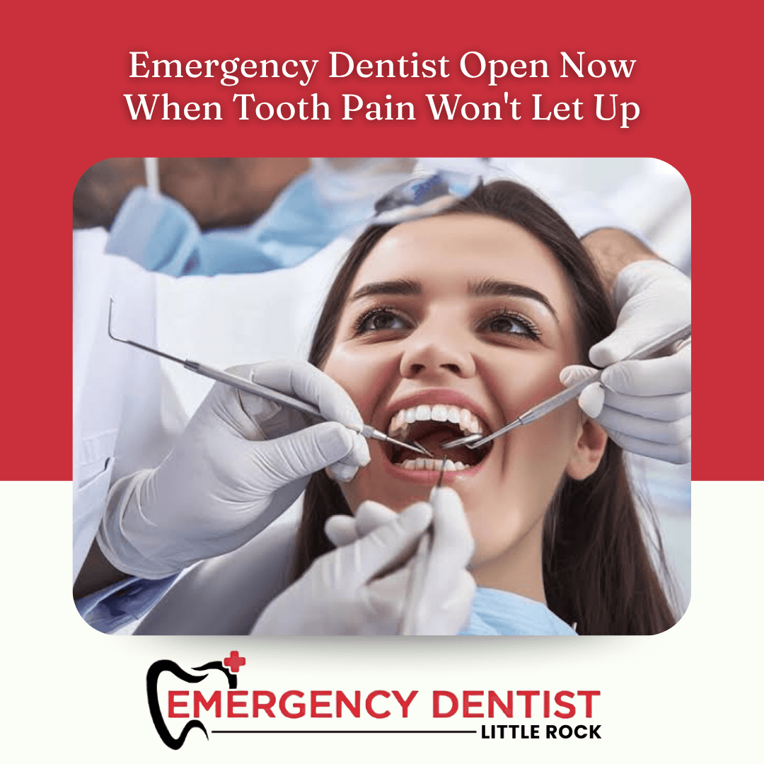 Emergency Dentist Little Rock