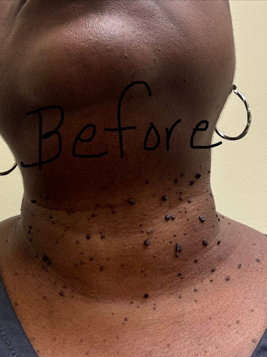 Center For Dermatology